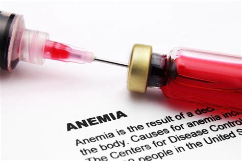 Megaloblastic Macrocytic Anemia - Net Health Book