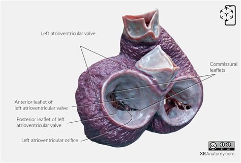 Left Atrioventricular Valve - In AR For Free