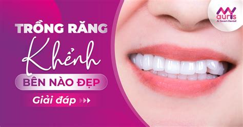 Trồng Răng Khểnh Bên Nào Đẹp: Bí Quyết Chọn Lựa Thẩm Mỹ Hoàn Hảo