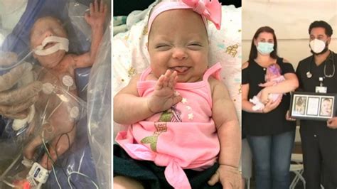 Micro preemie: Baby born at 1-pound-8-ounces, who spent 122 days in NICU, reunites with life ...