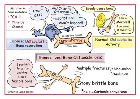 Osteopetrosis cartoons and illustrations - Creative Med Doses