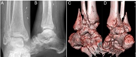 Male patient, 79 years, who had a fall during stay in cardiology ...