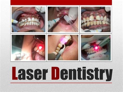 American Board of Laser Surgery Program (laser dentistry)