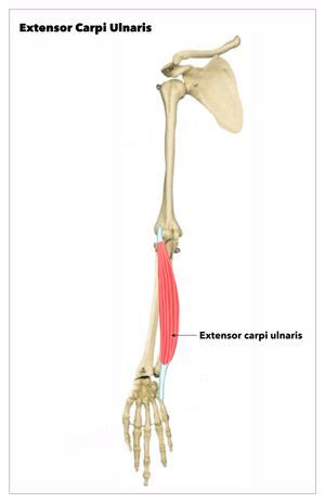 Extensor Carpi Ulnaris (ECU) Subluxation - Physiopedia