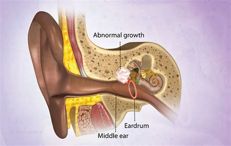 Health Condition : Symptoms, Causes, Treatment and More