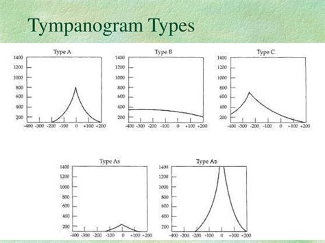 PPT - Anatomy and Physiology of the Ear PowerPoint Presentation - ID:628818