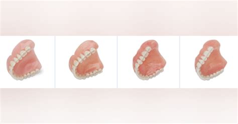 Aspen Dental practices introduce Denture Money-Back Guarantee | Dentistry IQ