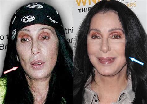 Cher: Before and After 2020