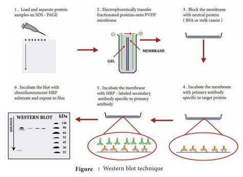 Western Blot techniques - Principle, Steps, Application | Immunology