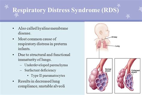 Pediatrics Notes: Respiratory Distress Syndrome Of Newborns - A Brief Discussion