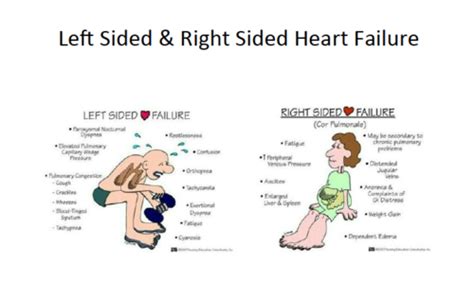 Complications of right sided heart failure