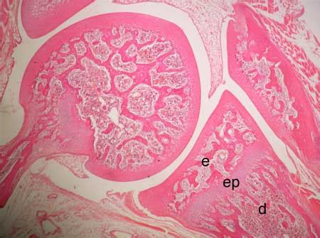 Epiphyseal plate