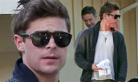 Zac Efron displays swollen face and large scar on his chin after ...