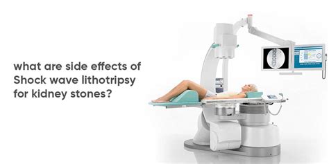 Risks and Side Effects of Shock Wave Lithotripsy for Kidney Stones