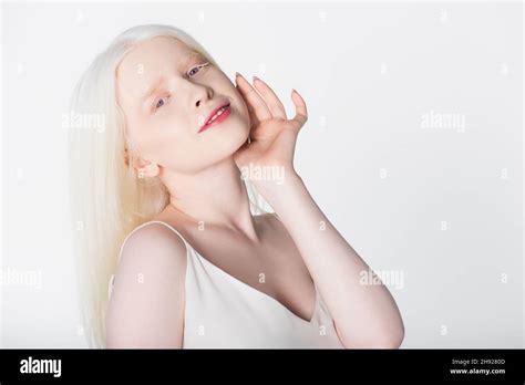 Smiling albino model looking at camera isolated on white Stock Photo ...