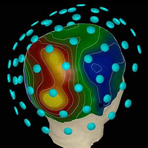 Magnetoencephalography (MEG) | Magnetoencephalography (MEG) … | Flickr