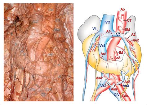 Kidney Cadaver