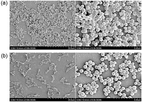 Spontaneous detachment of Streptococcus mutans biofilm by synergistic ...