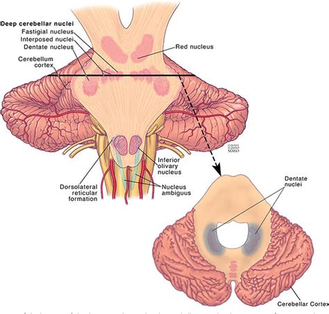 [PDF] Dentate Update: Imaging Features of Entities That Affect the ...