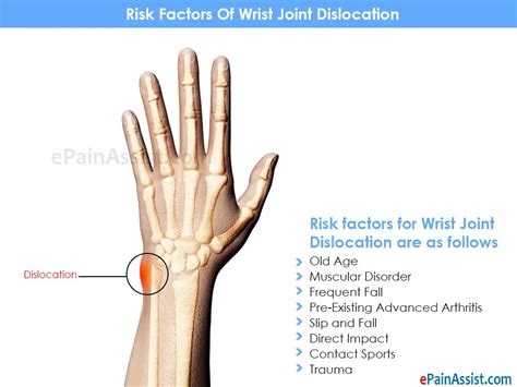 Wrist Pain: 9 Major Medical Conditions that Cause Wrist Pain or Wrist Joint Pain