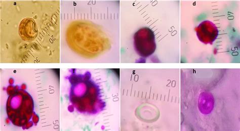 Sporulated oocysts × 1000; Fig. 3a showed intact unstained non treated... | Download Scientific ...