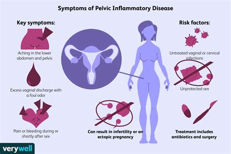 Een overzicht van Pelvic Inflammatory Disease (PID) - Med NL