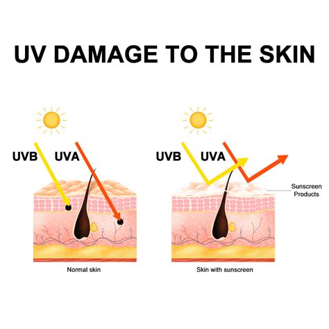 Red Light Therapy Side Effects: A Quick Guide – Bontanny