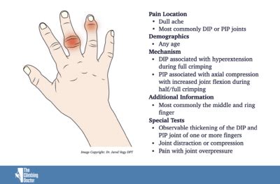 Capsulitis and Synovitis Climbing - Swelling of the Fingers - The Climbing Doctor