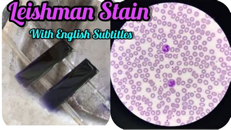 Leishman Stain Procedure||PBS Blood Smear Preparation||Haematology||DLC ...