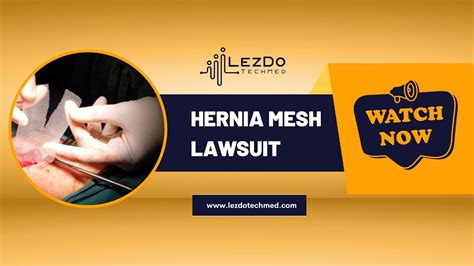 Hernia Mesh Lawsuit - YouTube