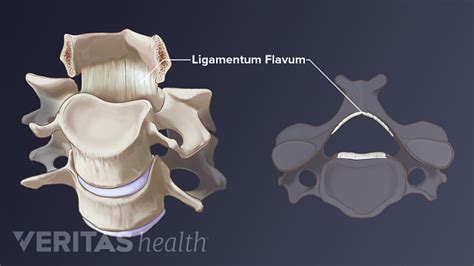 Ligamentum Flavum | Spine-health