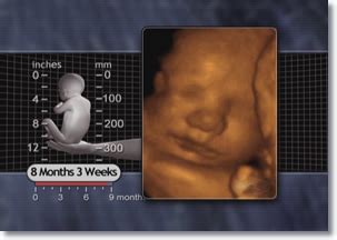 8 to 9 Months | Prenatal Overview