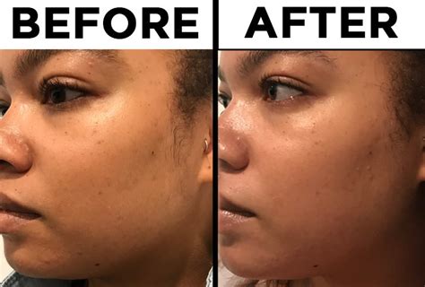 We Tried "The Ordinary" Skincare Line The Internet Is Talking About And ...