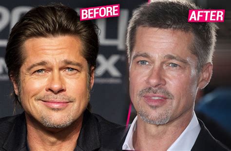 Revenge Facelift! Brad Pitt Has 'Fillers, Botox & Peels' In Wake Of ...