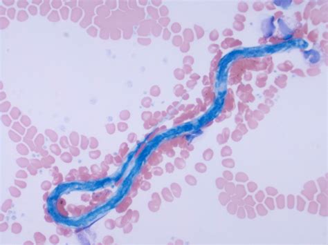 microfilaria – eClinpath