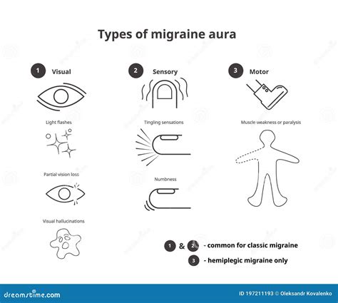 Types of Migraine Aura. Sensory, Visual and Motor Aura of the Classic ...