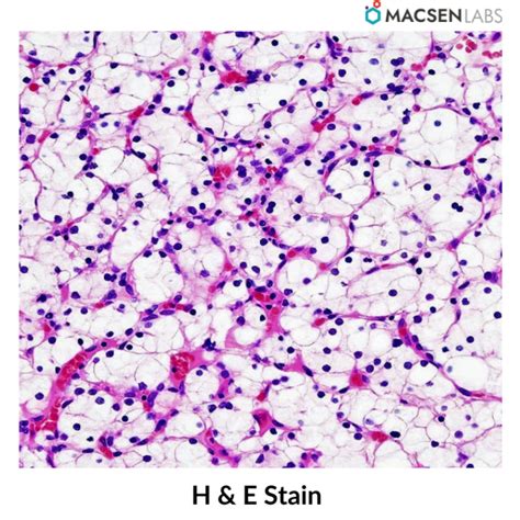 Eosin | Properties, Available variants & Uses