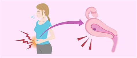 What Causes Implantation Cramping?