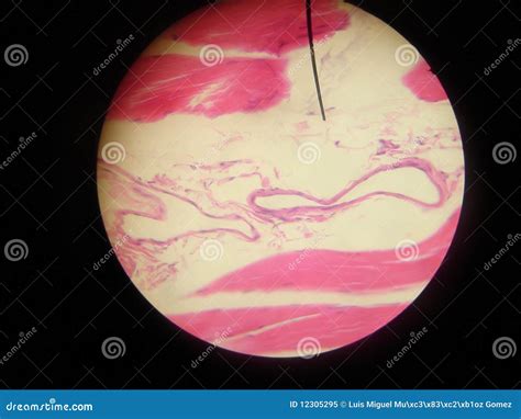 Veins At Microscope Royalty Free Stock Photo - Image: 12305295