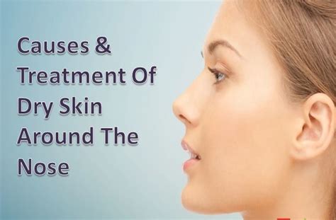 Know the Causes and Treatments of Dry Skin Around The Nose