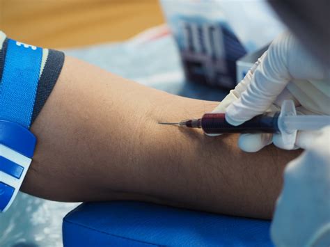 How to draw blood from a patient’s vein as painlessly as possible