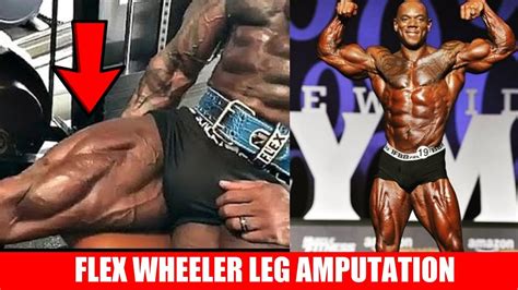 Flex Wheeler Has Emergency Leg Amputation! - Nick's Strength and Power - RapidFire Fitness