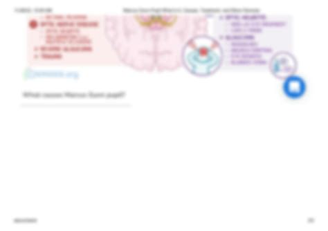 SOLUTION: Marcus gunn pupil what is it causes treatment and more osmosis - Studypool