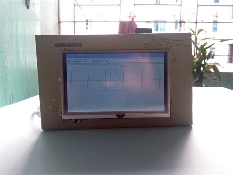 Portable ECG Machine : 9 Steps (with Pictures) - Instructables