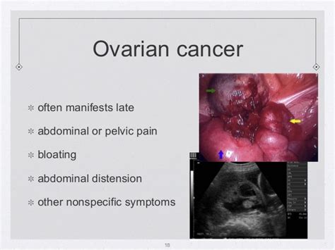 Evaluate pelvic tumours