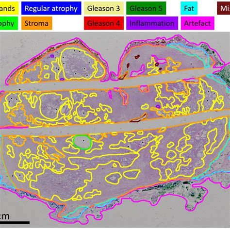 High-resolution picture of the histology slide with the different... | Download Scientific Diagram