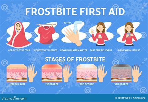 Frostbite Cartoons, Illustrations & Vector Stock Images - 3354 Pictures to download from ...