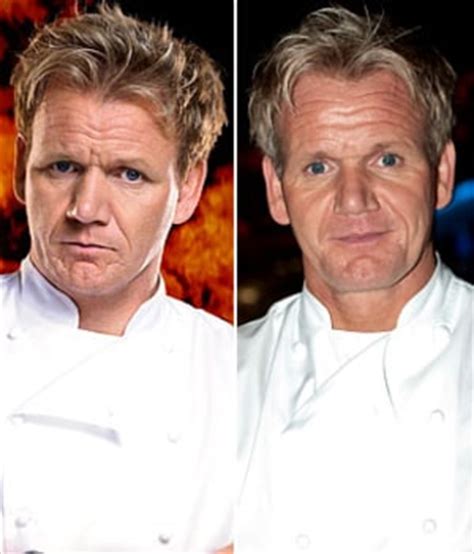 Gordan Ramsay Undergoes Chin Surgery - Us Weekly