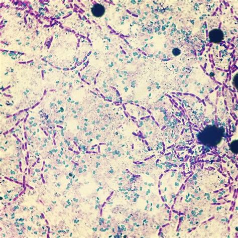 Spores of Bacillus cereus treated with the schaeffer fulton staining method. | Microorganismos, Coco