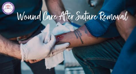 Wound Care After Suture Removal - Official Website of Essential Home ...